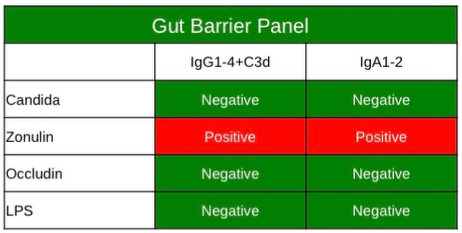 The Hidden Dangers of Glyphosate: Side Effects and Toxicity in Our Food