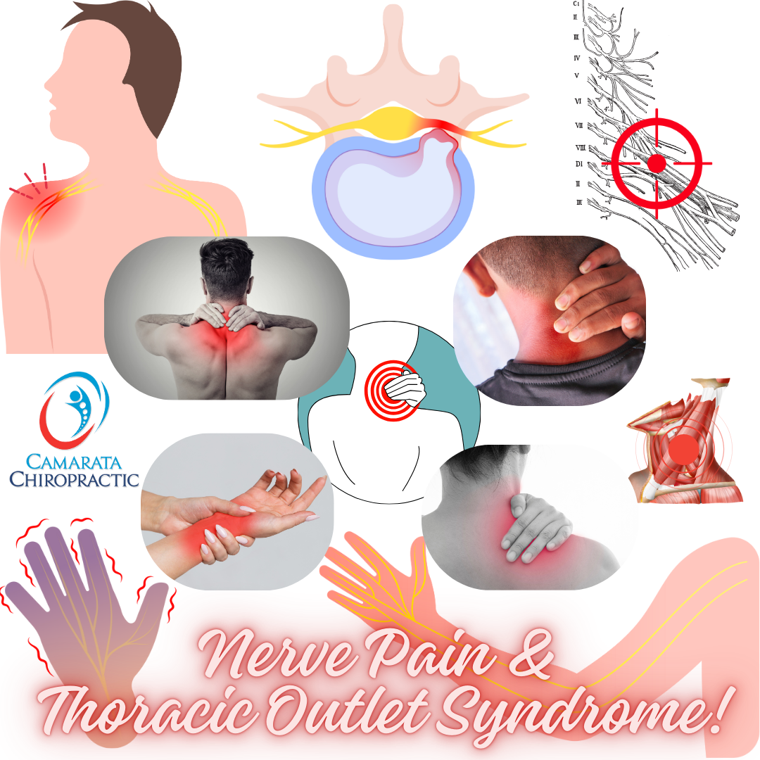 Nerve Pain & Thoracic Outlet Syndrome: Natural Relief Through Chiropractic, SoftWave Therapy, and Myofascial Release